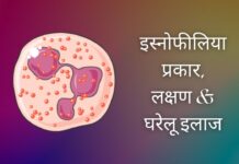 इस्नोफीलिया का घरेलू इलाज (Home Remedies for Eosinophils in Hindi)